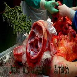 Drain Of Impurity : Head Disfigurement Autopsy